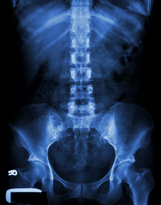 X-ray;