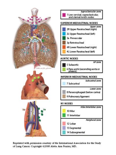 Diagnosis & Staging of Lung Cancer, 4th Edition | Lung Cancer